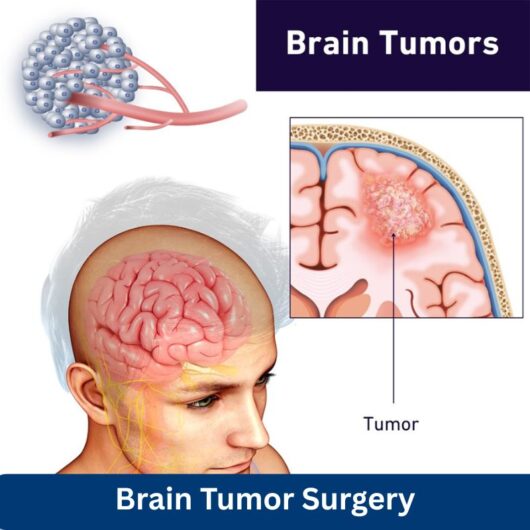 Best Minimal Invasive Neurosurgeon Mumbai
