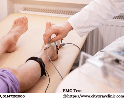 EMG-TEST