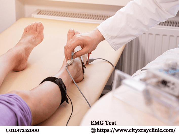 EMG Test Cost: Save on Nerve Health Checks Today
