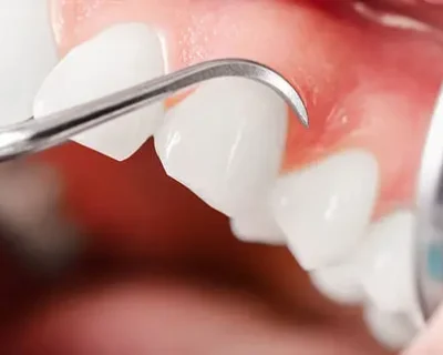 cascade-4