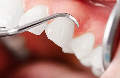 Experienced Dentist Merritt BC – Cascade Family Dental!