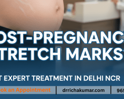 smart-promotions-1-new