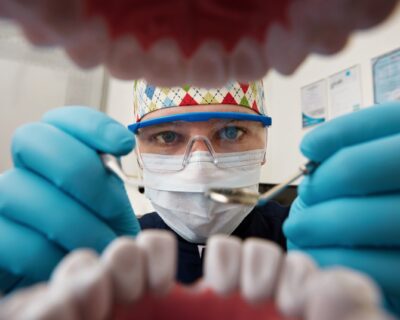 Crowns-and-Bridges-in-Noida