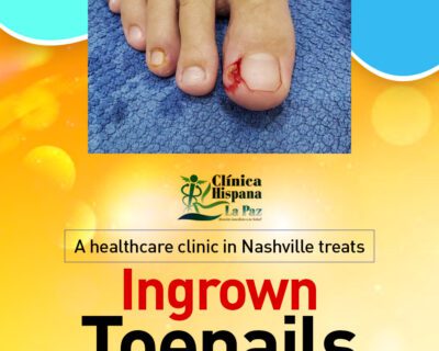 A-healthcare-clinic-in-Nashvilletreats-ingrown-toenails
