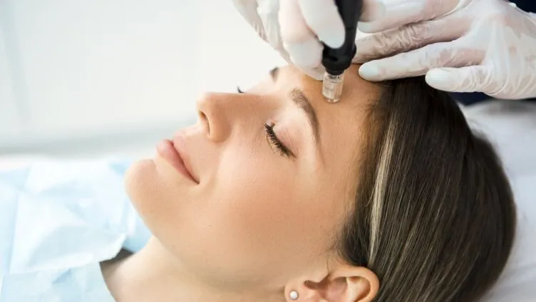 Microneedling in Surrey | Skin Rejuvenation Experts