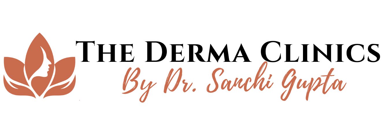 Effective Skin Fungal Infection Treatment – Safe & Fast Relief