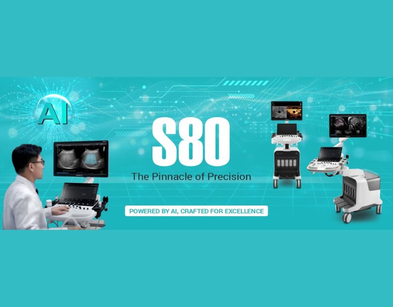 Medical Equipment Companies in India | Sonoscape India
