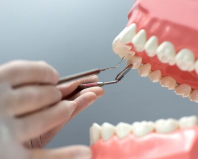 Dental-Bridges-Arizona