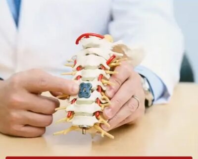Spinal-Fusion-Surgery-in-india