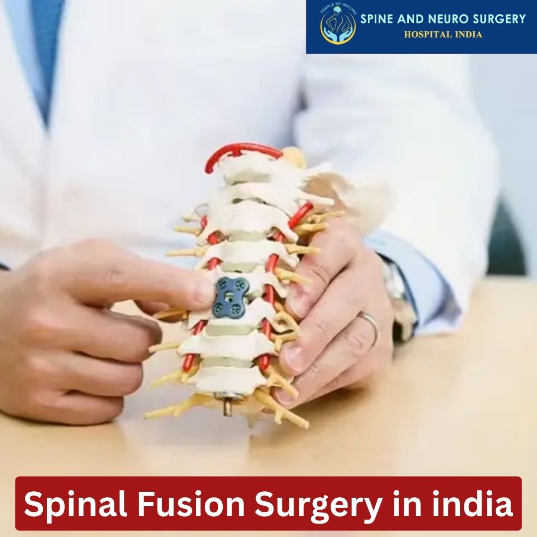 Spinal Fusion Treatment in India