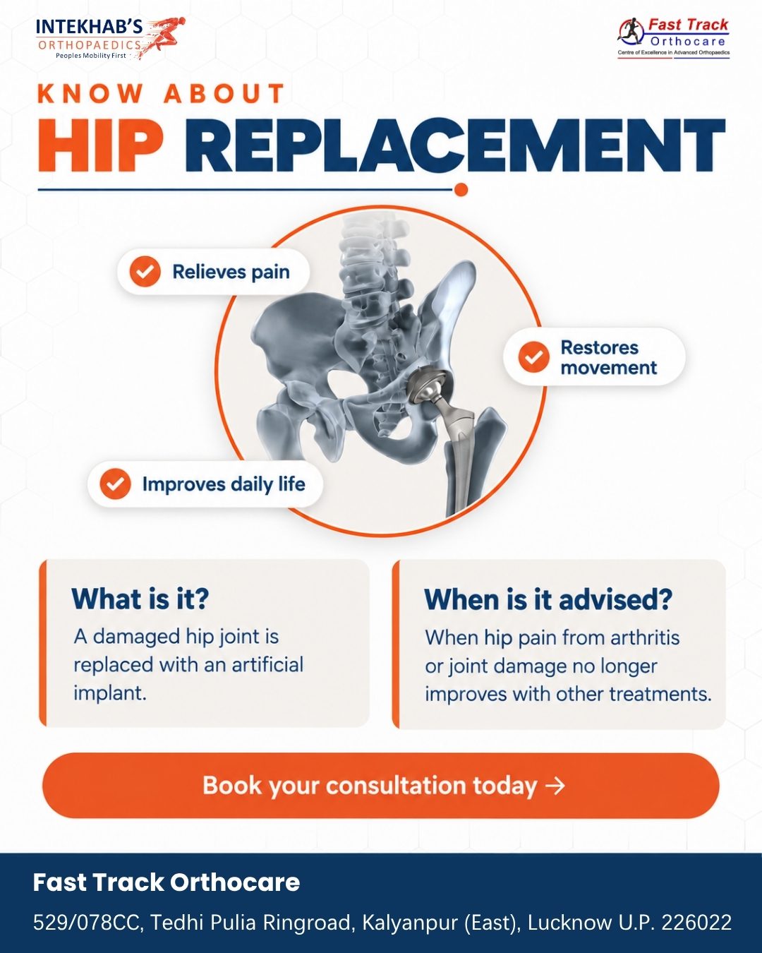 Hip replacement surgeon in Lucknow – Dr Intekhab Alam