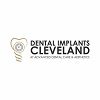 Dental-implants-cleveland-logo