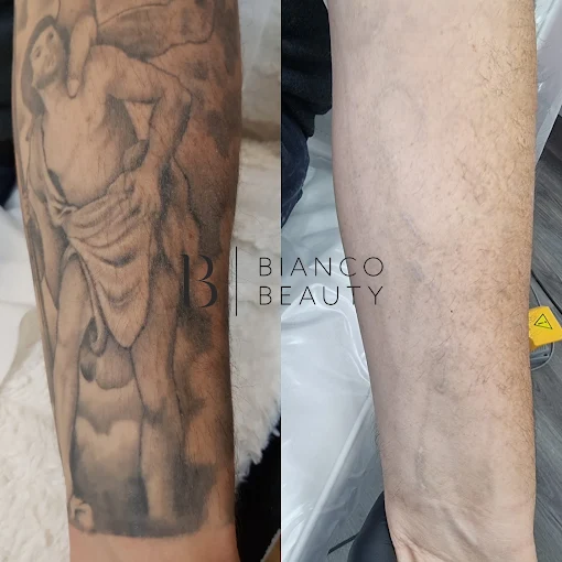 Bianco Beauty Milton Keynes